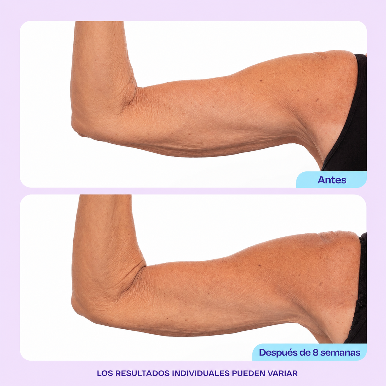 GO PURE 50ML TIGHEN & LIFT NECK®